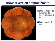 UE 35 DR GAUCHER Orthoptie dépistage diabète