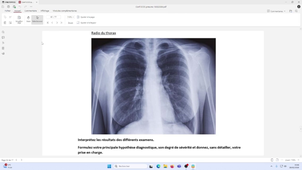 Conférence ECOS#5 - Pneumologie