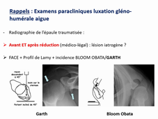 TD_DFGSM3_12B_2020_Luxation et instabilite epaule_Dr BALDAIRON