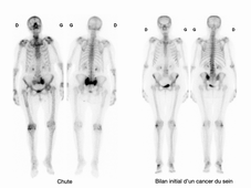 TP Rayons X / médecine nucléaire