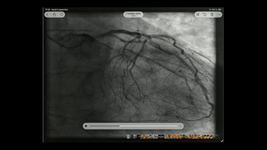 anatomie du coeur et vascularisation