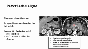 Imagerie abdomen pelvis - Douleurs pancréatiques