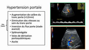 Imagerie abdomen pelvis - Cirrhose