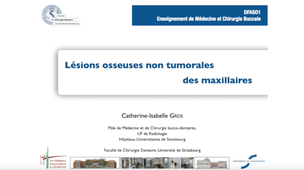 DFASO1 - MCB - Lésions osseuses non tumorales des maxillaires