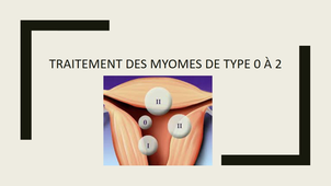 DEFOPE e-FAMG /  Fibromes Utérins Dr Lecointre