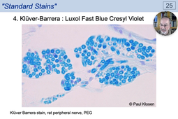 04 - Classical Staining Techniques - Myelin stains.mp4