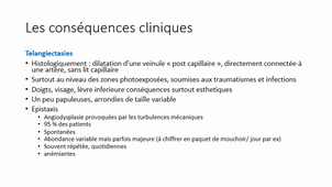Maladie de Rendu-Osler-Weber