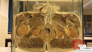 TP Anatomie DFGSM2-pelvis