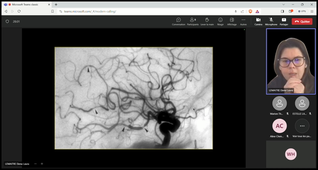 IPAU - Céphalées, migraines à céphalées inhabituelles, vertiges, troubles de l'équilibre, déficit sensitif - E. LEMAITRE
