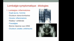 Lombalgies symptomatique