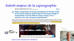 Intubation difficile : matériel.