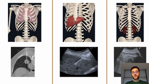 Imagerie interventionnelle - biopsies