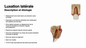 Traumatologie alvéolo-dentaire_Les luxations