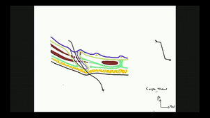UE2 - AN3 points faibles - canal inguinal