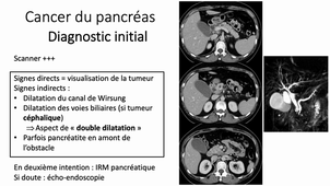 Imagerie abdomen pelvis - Ictère