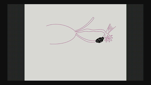 utérus / vagin / ligament large