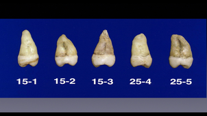 5AN24 VAN BELLINGHEN