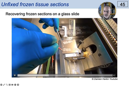 04 - Basic Histological Technique - Frozen Sections.mp4