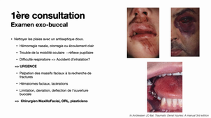 Traumatologie dentaire-Diagnostic et prise en charge thérapeutique