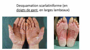 5SM2 : séméiologie dermatologique 2