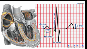 Soirée ECG - Dr Arzouk - Pr Vogel