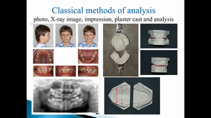 Pr. Tatjana Dostalova: Intraoral and facial 3D scanner monitoring of growth and therapy in family with amelogenesis imperfecta